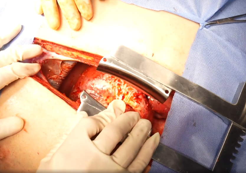 胸腹部损伤控制手术模拟人系统3.0